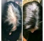 Organic Hairfall Oil(175ml)made in Thailand - Image 4