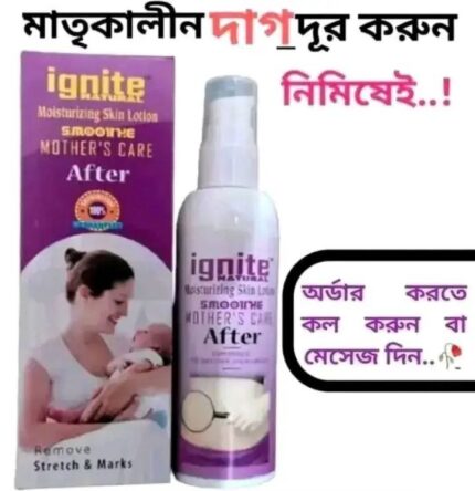 Ignite Mother Care Lotion(After)