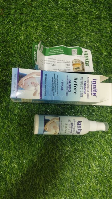 Ignite Mother Care Lotion(before)